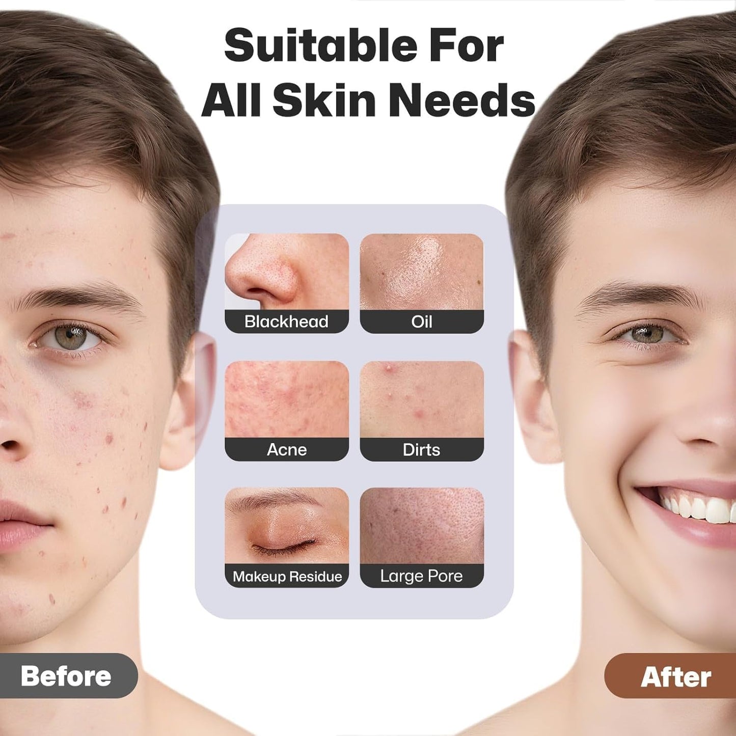 Facial Cleansing Brush, Rechargeable Silicone Face Scrubber with Heat Massage End, Vibrating Exfoliator Scrubber for Deep Cleaning, Waterproof Face Brush for Women and Men (Black)