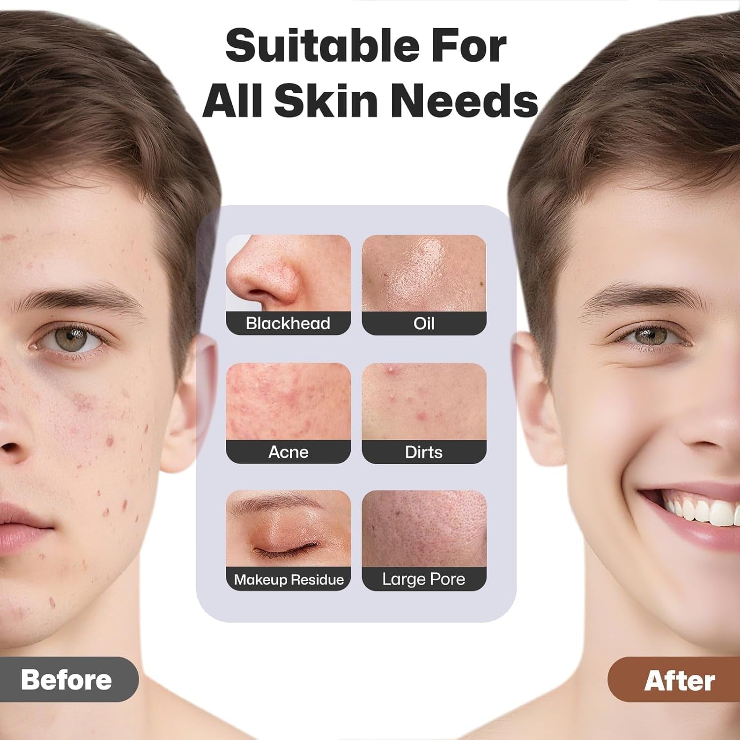 Facial Cleansing Brush, Rechargeable Silicone Face Scrubber with Heat Massage End, Vibrating Exfoliator Scrubber for Deep Cleaning, Waterproof Face Brush for Women and Men (Black)