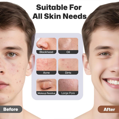 Facial Cleansing Brush, Rechargeable Silicone Face Scrubber with Heat Massage End, Vibrating Exfoliator Scrubber for Deep Cleaning, Waterproof Face Brush for Women and Men (Black)